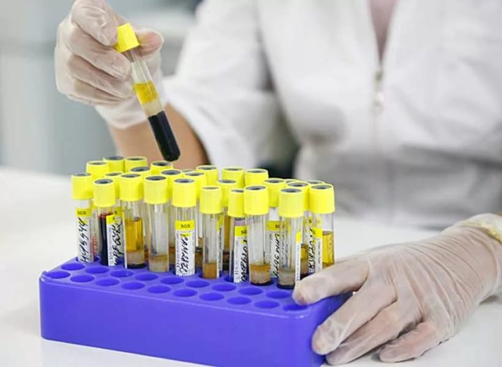 Чим небезпечна аденома наднирника у жінок? » журнал здоров'я iHealth 3