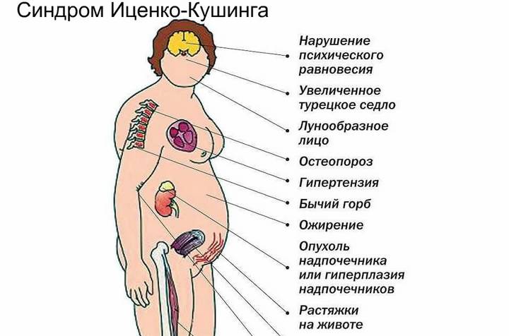 Навіщо потрібен гормон інсулін в організмі? » журнал здоров'я iHealth 1